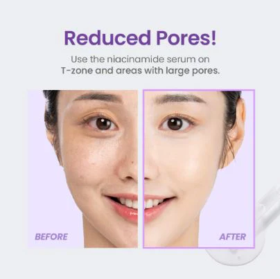 TIRTIR Niacinamide 20% Serum 30ML - Imagen 5